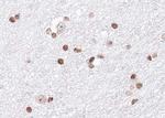 hnRNP A1 Antibody in Immunohistochemistry (Paraffin) (IHC (P))