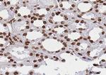 hnRNP M1-M4 Antibody in Immunohistochemistry (Paraffin) (IHC (P))