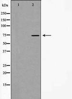 hnRNP M1-M4 Antibody in Western Blot (WB)