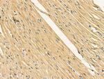 Kir6.2 (KCNJ11) Antibody in Immunohistochemistry (Paraffin) (IHC (P))