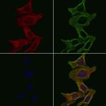 Kir6.2 (KCNJ11) Antibody in Immunocytochemistry (ICC/IF)