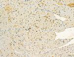 MKL1 Antibody in Immunohistochemistry (Paraffin) (IHC (P))