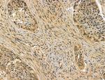 MKL1 Antibody in Immunohistochemistry (Paraffin) (IHC (P))