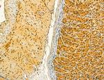 MKL1 Antibody in Immunohistochemistry (Paraffin) (IHC (P))