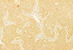 PERK Antibody in Immunohistochemistry (Paraffin) (IHC (P))