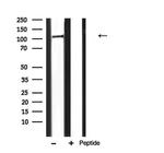 PERK Antibody in Western Blot (WB)