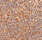 NOTCH1 (Cleaved Val1744) Antibody in Immunohistochemistry (Paraffin) (IHC (P))