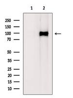 NOTCH1 (Cleaved Val1744) Antibody in Western Blot (WB)