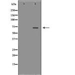 MTA1 Antibody in Western Blot (WB)