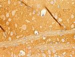 beta Synuclein Antibody in Immunohistochemistry (Paraffin) (IHC (P))