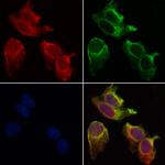 beta Synuclein Antibody in Immunocytochemistry (ICC/IF)