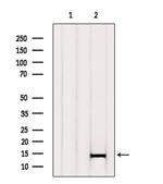 beta Synuclein Antibody in Western Blot (WB)