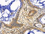 ACTA1 Antibody in Immunohistochemistry (Paraffin) (IHC (P))