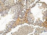 ACTA1 Antibody in Immunohistochemistry (Paraffin) (IHC (P))