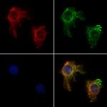 ACTA1 Antibody in Immunocytochemistry (ICC/IF)