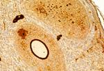 Fibronectin Antibody in Immunohistochemistry (Paraffin) (IHC (P))