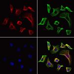 FAP Antibody in Immunocytochemistry (ICC/IF)