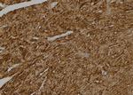 Caspase 6 (Cleaved Asp179) Antibody in Immunohistochemistry (Paraffin) (IHC (P))