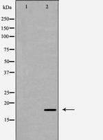 Caspase 6 (Cleaved Asp179) Antibody in Western Blot (WB)