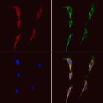 BMPR2 Antibody in Immunocytochemistry (ICC/IF)