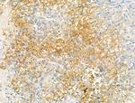 BMPR2 Antibody in Immunohistochemistry (Paraffin) (IHC (P))