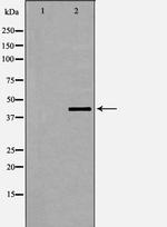 Phospho-Dematin (Ser403) Antibody in Western Blot (WB)