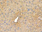 RhoH Antibody in Immunohistochemistry (Paraffin) (IHC (P))