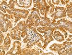 Tyrosinase Antibody in Immunohistochemistry (Paraffin) (IHC (P))