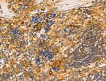 Tyrosinase Antibody in Immunohistochemistry (Paraffin) (IHC (P))