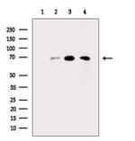 Tyrosinase Antibody in Western Blot (WB)