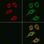 Tyrosinase Antibody in Immunocytochemistry (ICC/IF)