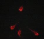 Tyrosinase Antibody in Immunocytochemistry (ICC/IF)