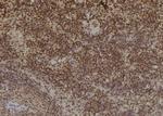 Tyrosinase Antibody in Immunohistochemistry (Paraffin) (IHC (P))