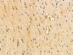 TNFAIP6 Antibody in Immunohistochemistry (Paraffin) (IHC (P))