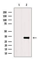 TNFAIP6 Antibody in Western Blot (WB)