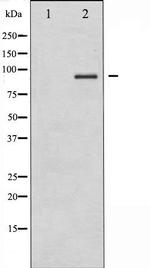 IKK alpha/beta Antibody in Western Blot (WB)