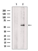 DOK2 Antibody in Western Blot (WB)