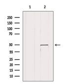 VDR Antibody in Western Blot (WB)