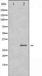 RPA32 Antibody in Western Blot (WB)