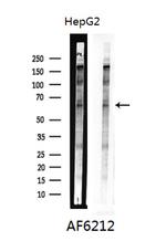 Elk1 Antibody in Western Blot (WB)