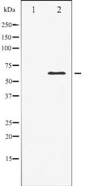 Elk1 Antibody in Western Blot (WB)