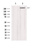 Filamin A Antibody in Western Blot (WB)