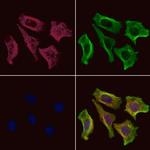 SHC Antibody in Immunocytochemistry (ICC/IF)