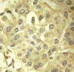 SHC Antibody in Immunohistochemistry (Paraffin) (IHC (P))