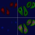 BRCA1 Antibody in Immunocytochemistry (ICC/IF)