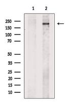 BRCA1 Antibody in Western Blot (WB)