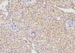 ETK Antibody in Immunohistochemistry (Paraffin) (IHC (P))