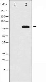 ETK Antibody in Western Blot (WB)