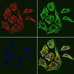 RHOA Antibody in Immunocytochemistry (ICC/IF)