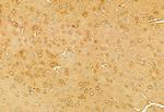 RHOA Antibody in Immunohistochemistry (Paraffin) (IHC (P))